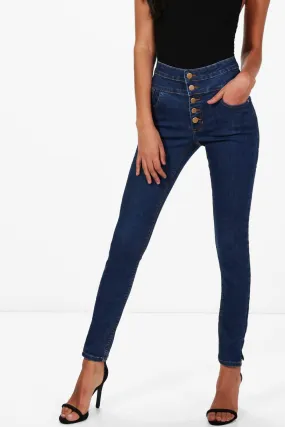 5 Button Ultra High Waist Skinny Jeans